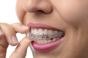Effektive Ansätze zur Zahnkorrektur und ästhetischen Angleichung