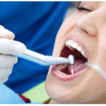 Wichtige Faktoren bei der Wahl der Zahnprophylaxe: Ein Leitfaden