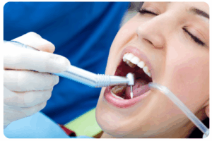 Wichtige Faktoren bei der Wahl der Zahnprophylaxe: Ein Leitfaden